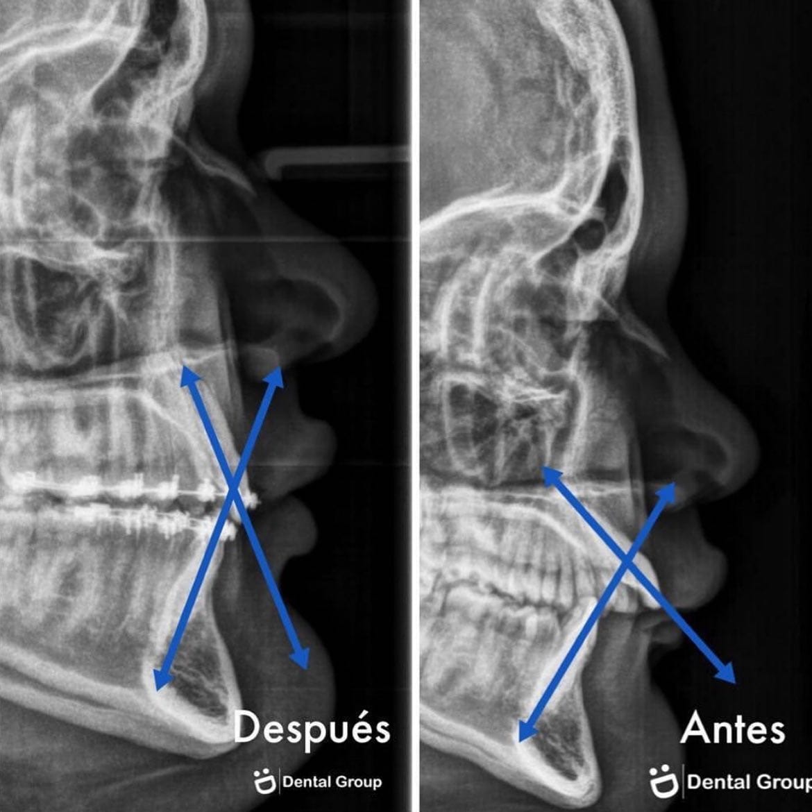 Antes y después — caso real de Dental Group Panama