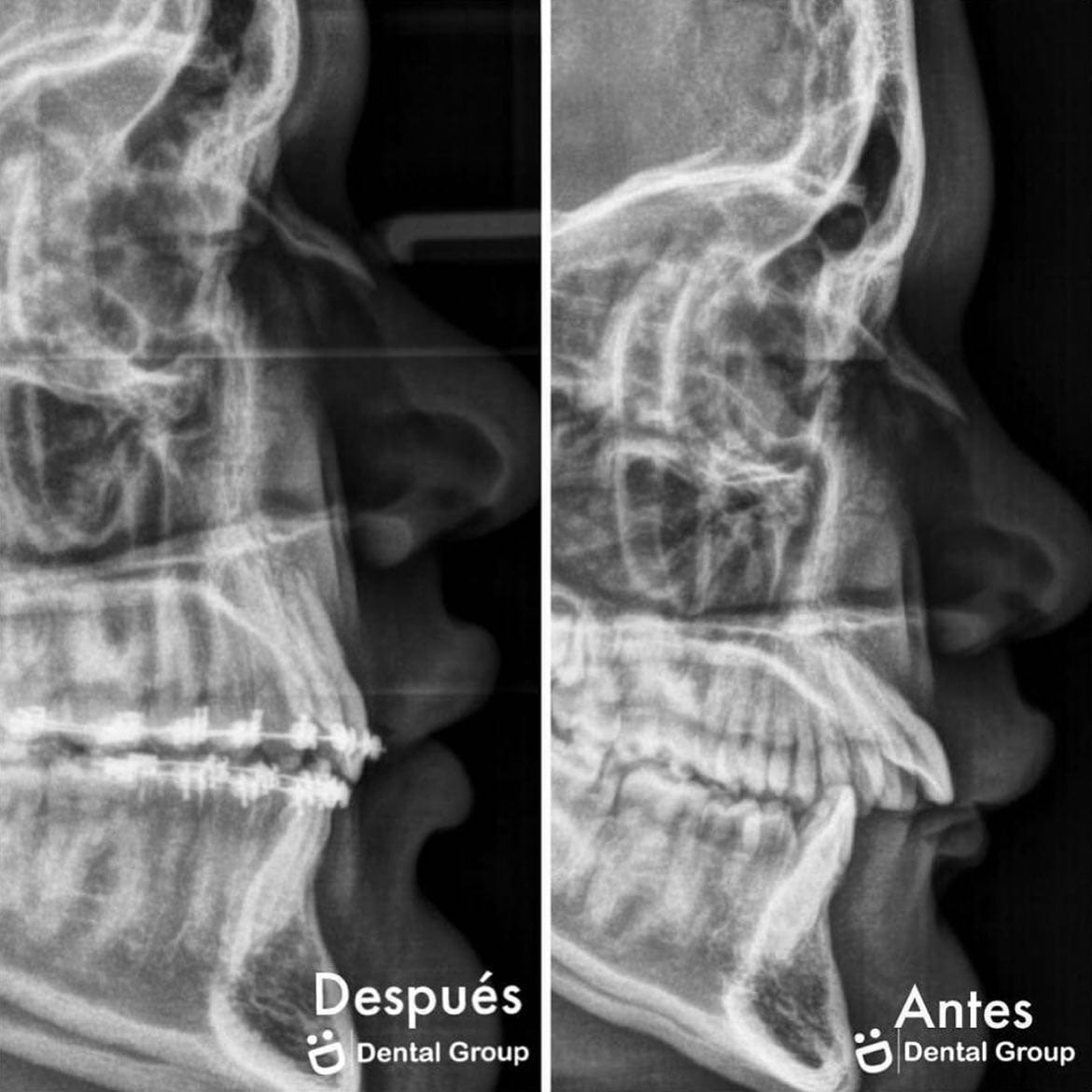 Antes y después — caso real de Dental Group Panama