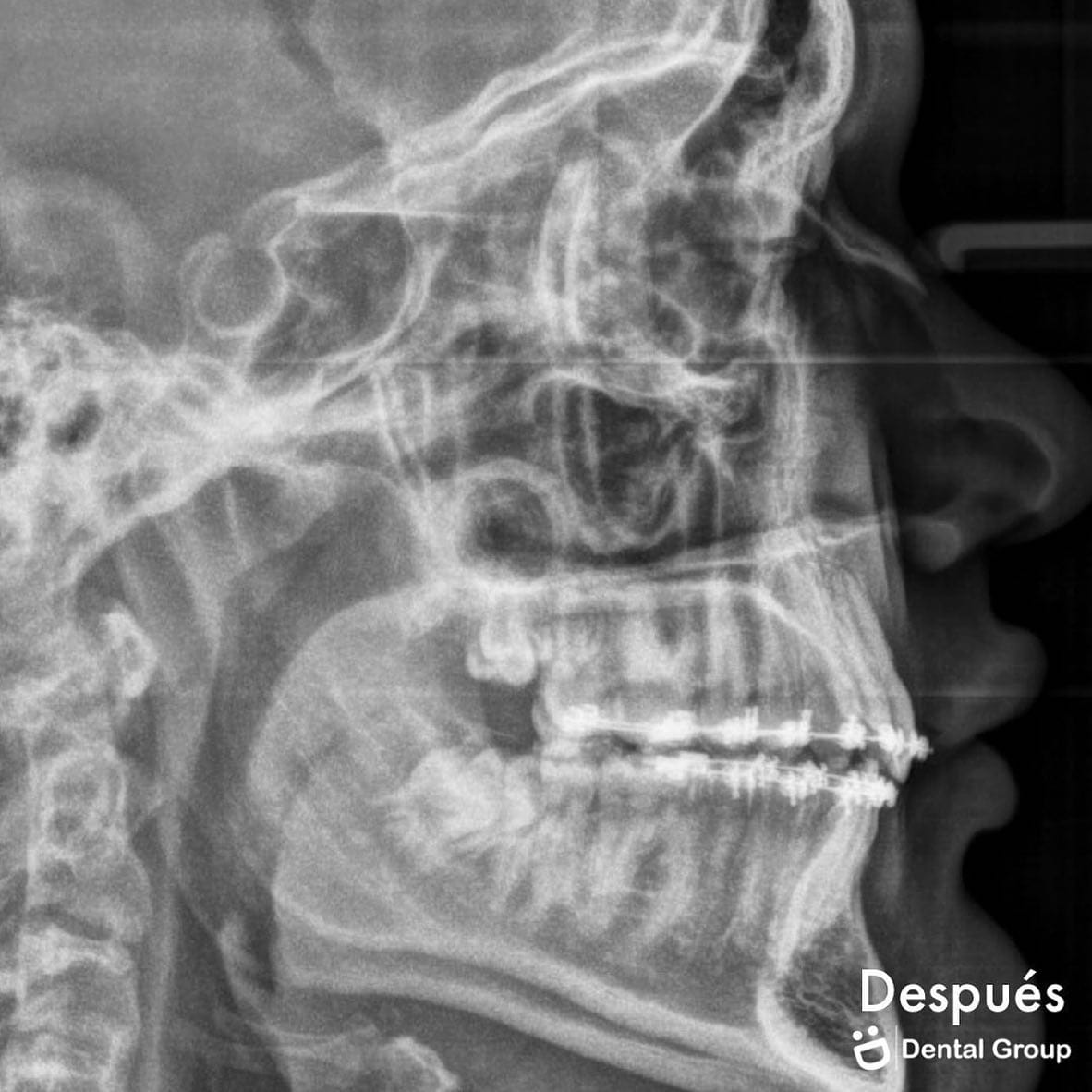 Antes y después — caso real de Dental Group Panama