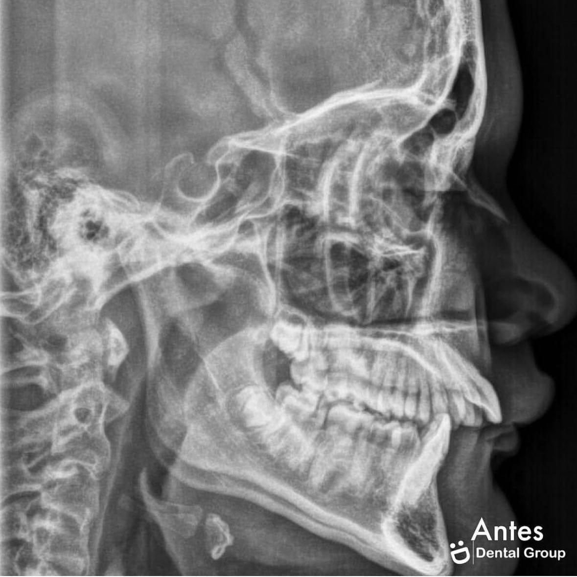 Antes y después — caso real de Dental Group Panama