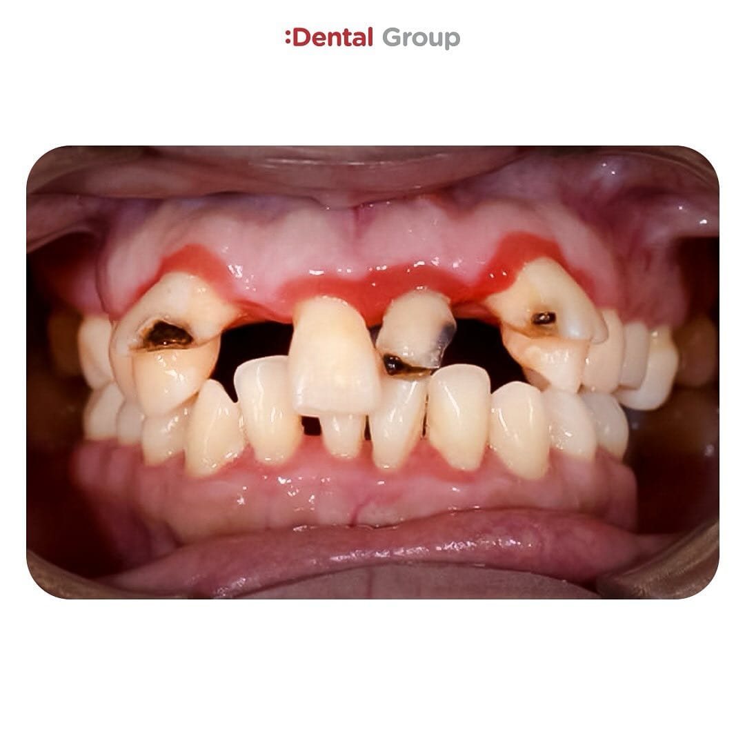 Antes y después — caso real de Dental Group Panama